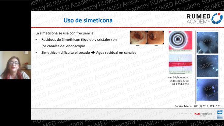 Procesamiento de endoscopios flexibles: descripción general y referencia al nuevo folleto de AKI